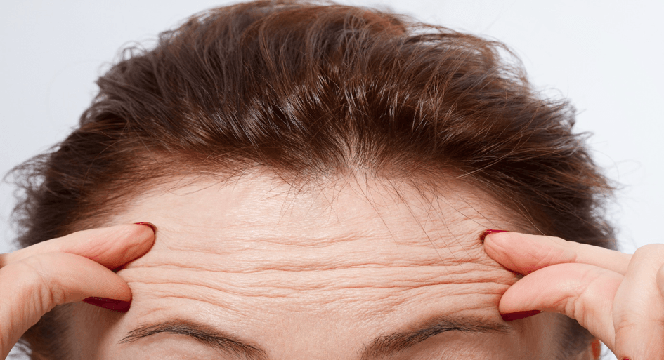 Top 12 areas Botox is used